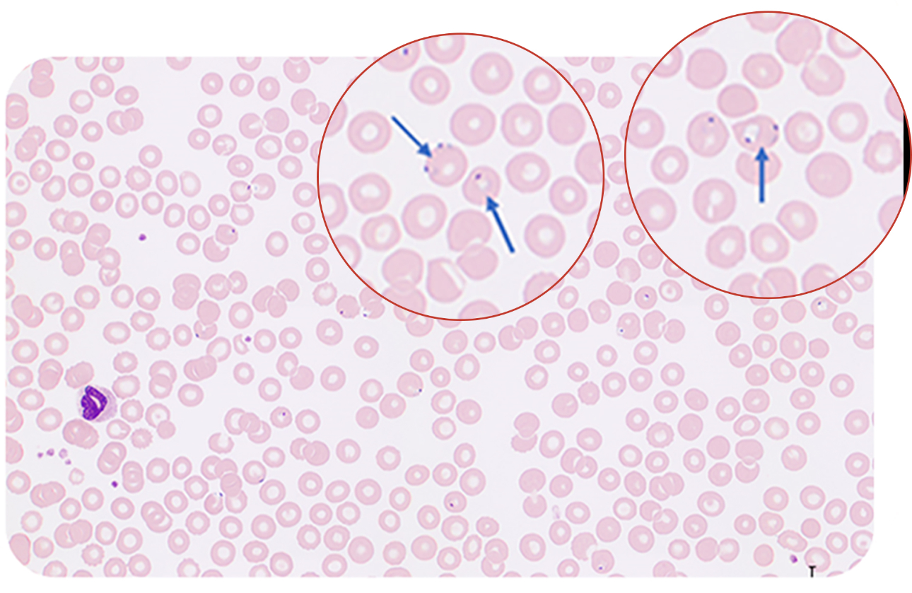 maurer-pigment-fig7-pc