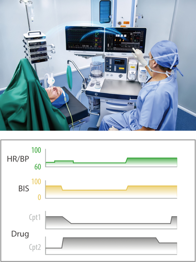 benefusion-n-series-anaesight-with-integrated-assessment-1.0-en