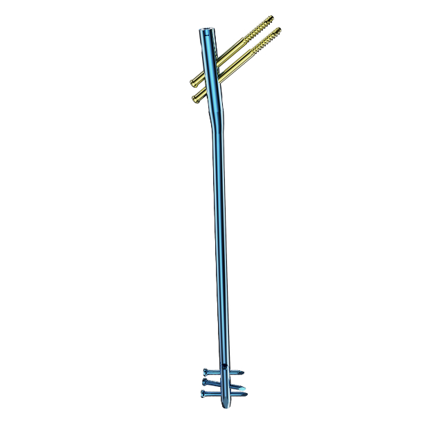 MR Femoral Nail