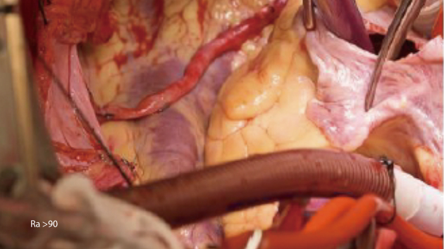 hyled-q-series-true-colors-1.0-en