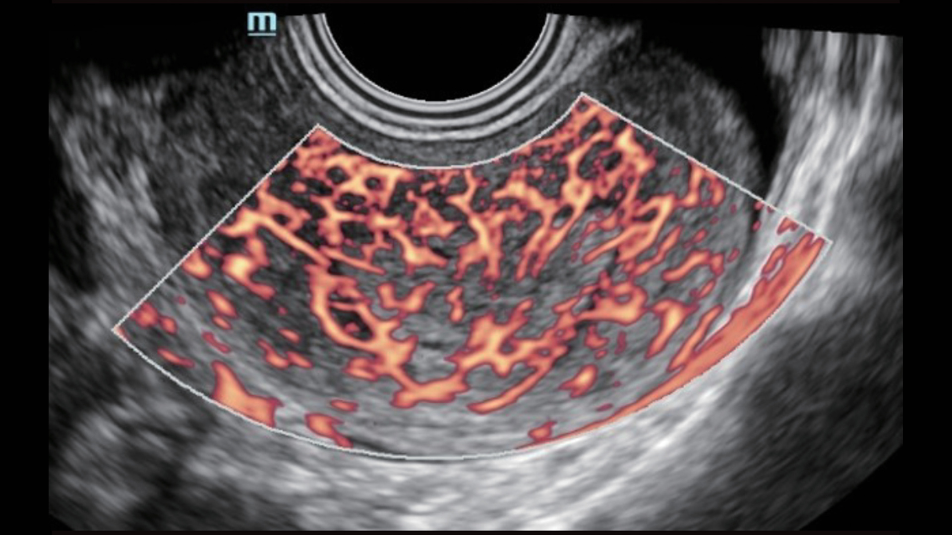 pg电子游戏(试玩)官方网站-APP下载