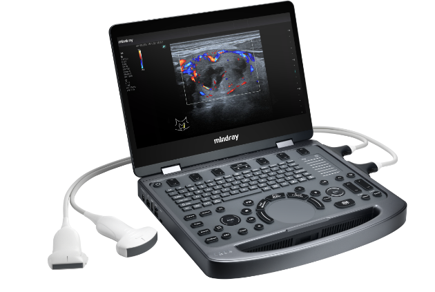 MX3 product left view with transducers