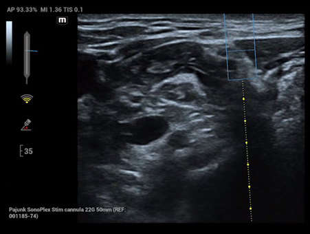 pg电子游戏(试玩)官方网站-APP下载