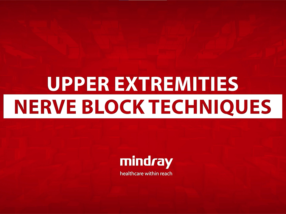 redblockshowheader960x720