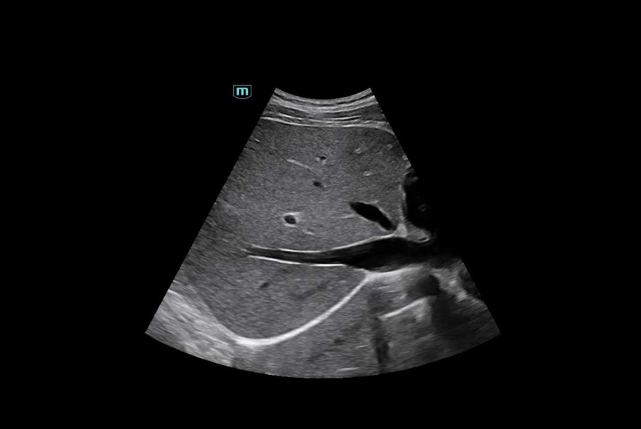 2D_Liver_N9_HD_Zoom_1260x844