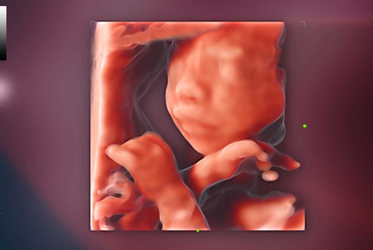 Fetal_Face_iLive_N9_HD_Zoom_1260x844