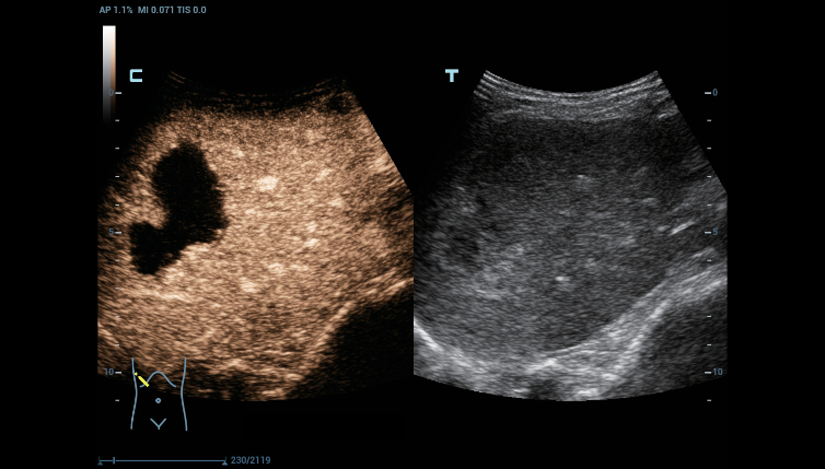 dc-80-exp-ru-fig3-2-pc