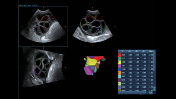 dc-80-exp-ru-fig4-2-pc