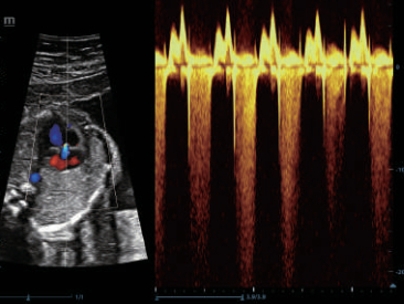 dc-80-exp-ru-fig7-12