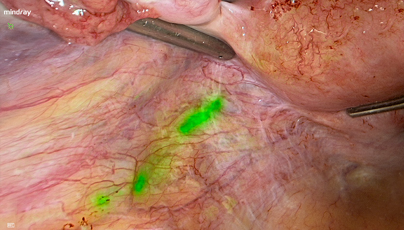 pg电子游戏(试玩)官方网站-APP下载