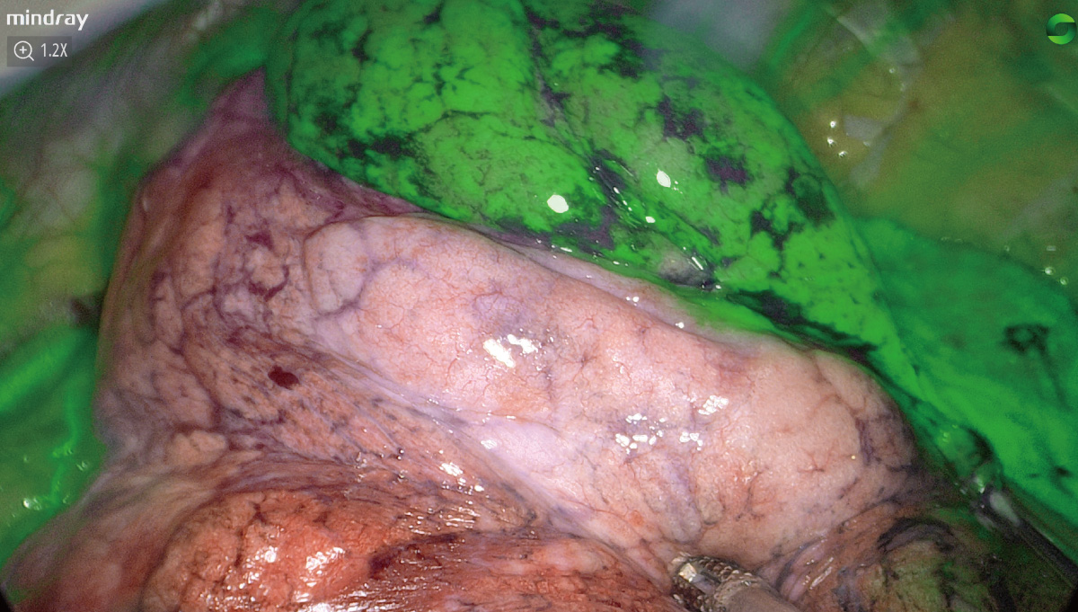 pg电子游戏(试玩)官方网站-APP下载