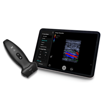 Mindray Introduces TE Air e5M Wireless Handheld Ultrasound to Revolutionize Whole-Body Scanning