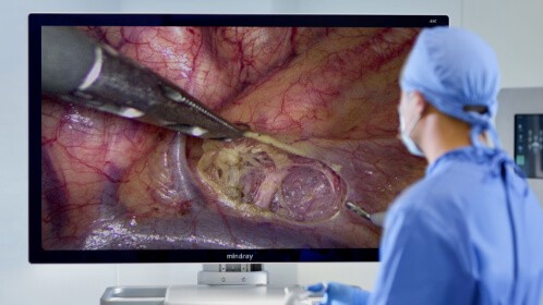 Camerasysteem voor endoscopie