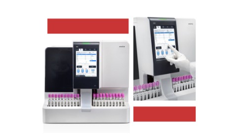 糖化血红卵白剖析仪